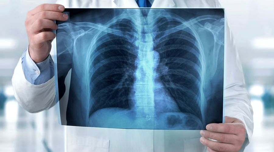 Clicca per accedere all'articolo Radiodiagnostica e radioprotezione: la conoscenza al giusto prezzo (biologico)
