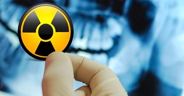 Clicca per accedere all'articolo Sabato 3 dicembre 2022: "ESPOSIZIONI RADIOLOGICHE. Responsabilità ed obblighi del medico alla luce del DLG  101/2020" 